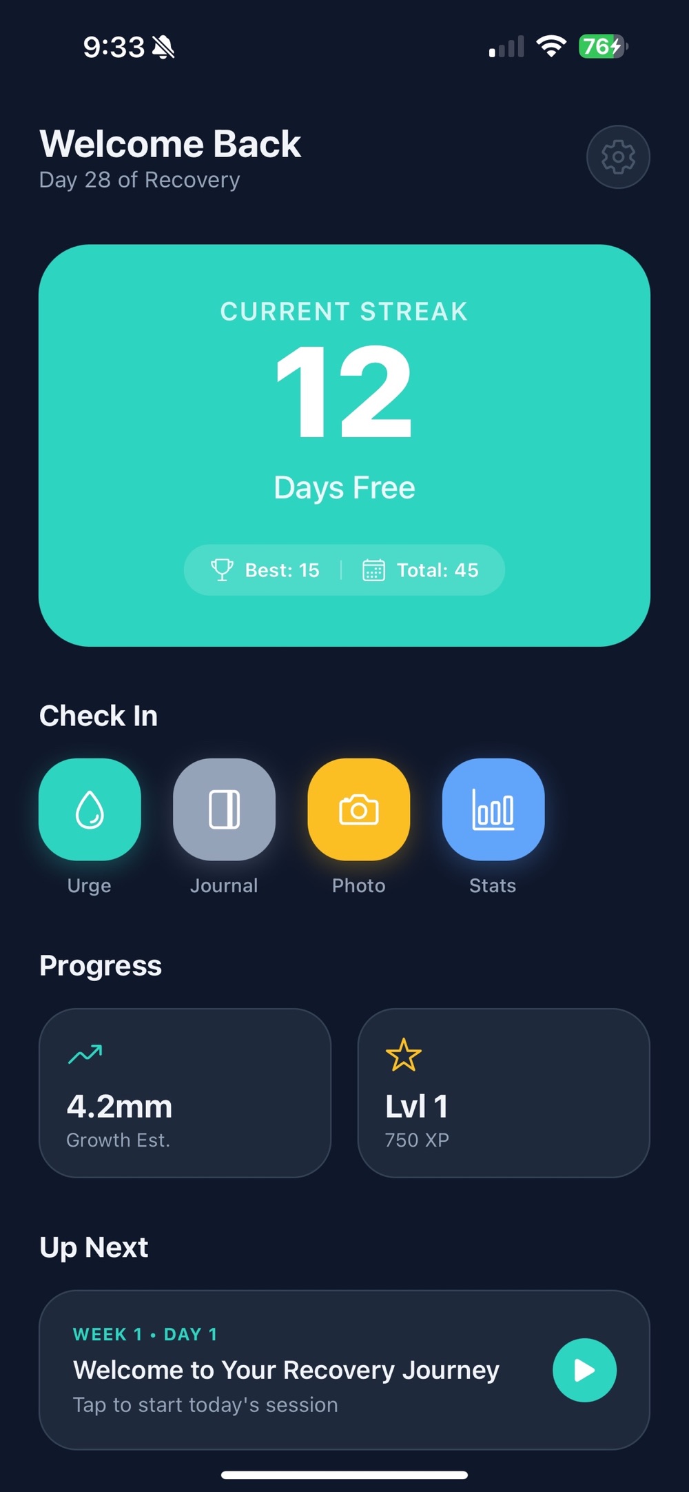 Nailwell home screen on day 28 of recovery, with a teal current streak card reading 12 days free alongside a best streak of 15 and 45 total, Check In buttons for urge, journal, photo and stats, progress tiles showing 4.2mm growth estimate and level 1 at 750 XP, and an Up Next session card.